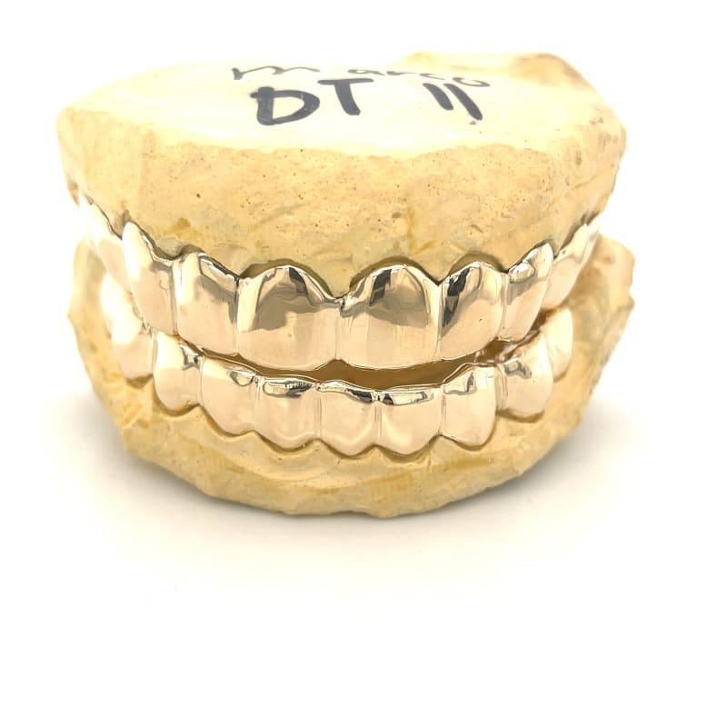 20pc High Polished Gold Grillz - Seattle Gold Grillz