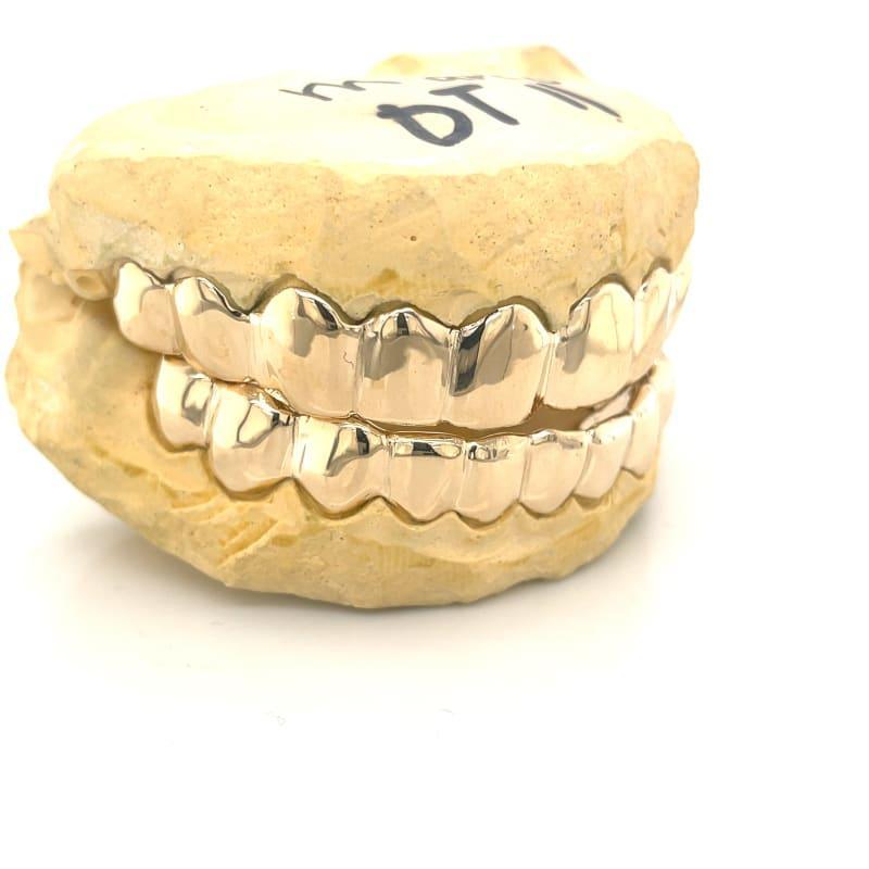 20pc High Polished Gold Grillz - Seattle Gold Grillz