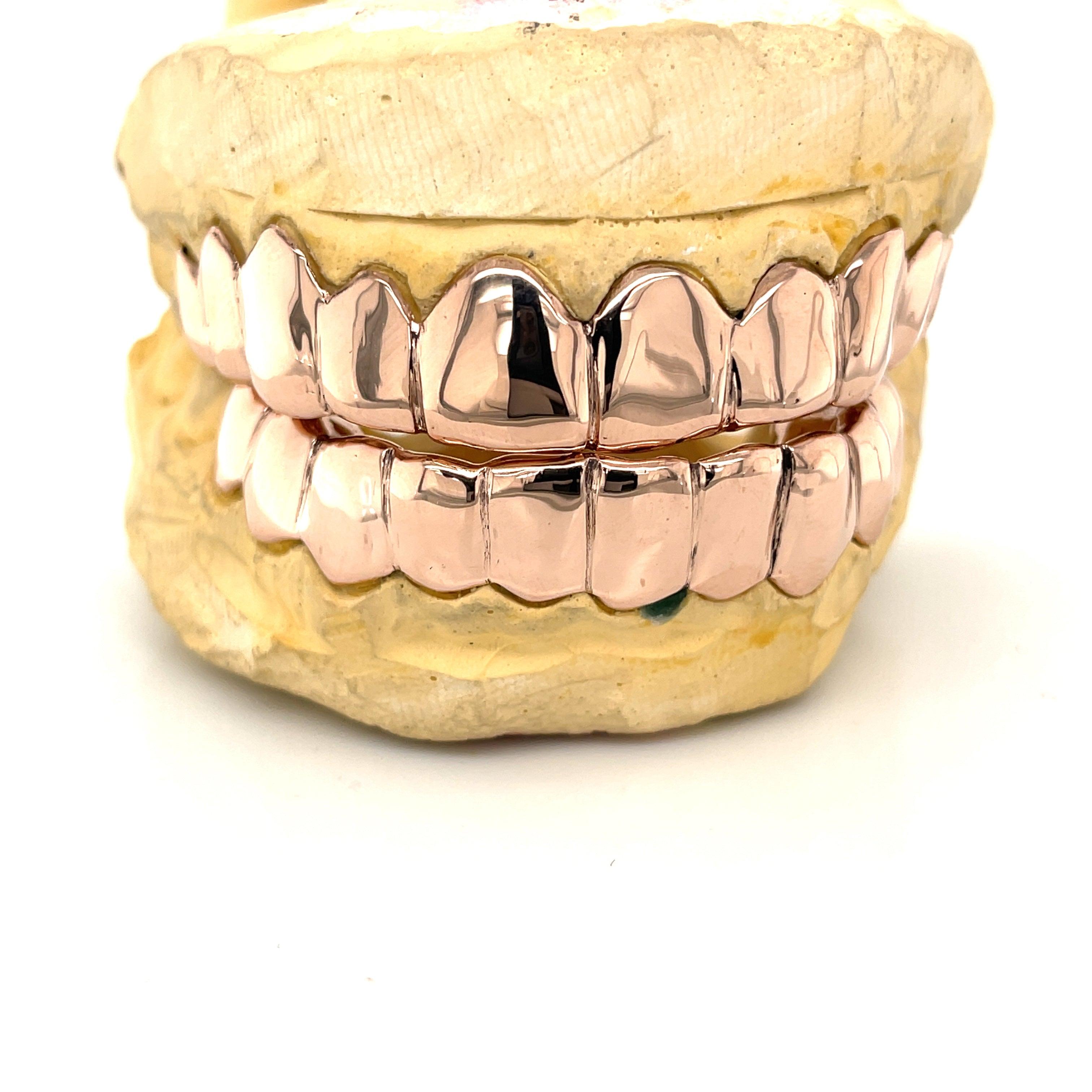 20pc High Polished Gold Grillz - Seattle Gold Grillz