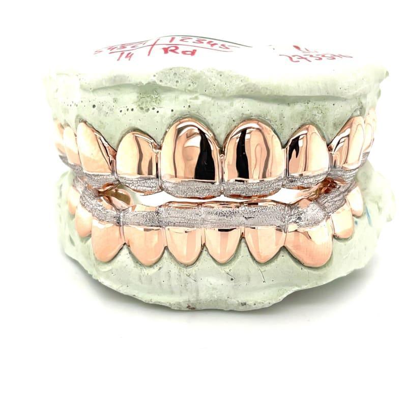 20pc Rose Gold Dusted Grillz - Seattle Gold Grillz