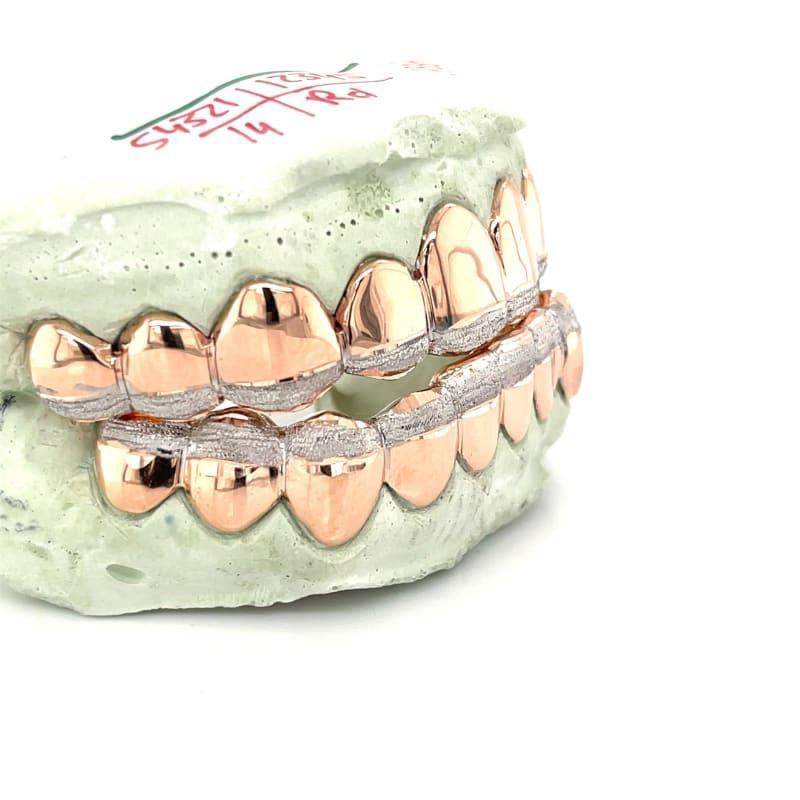 20pc Rose Gold Dusted Grillz - Seattle Gold Grillz