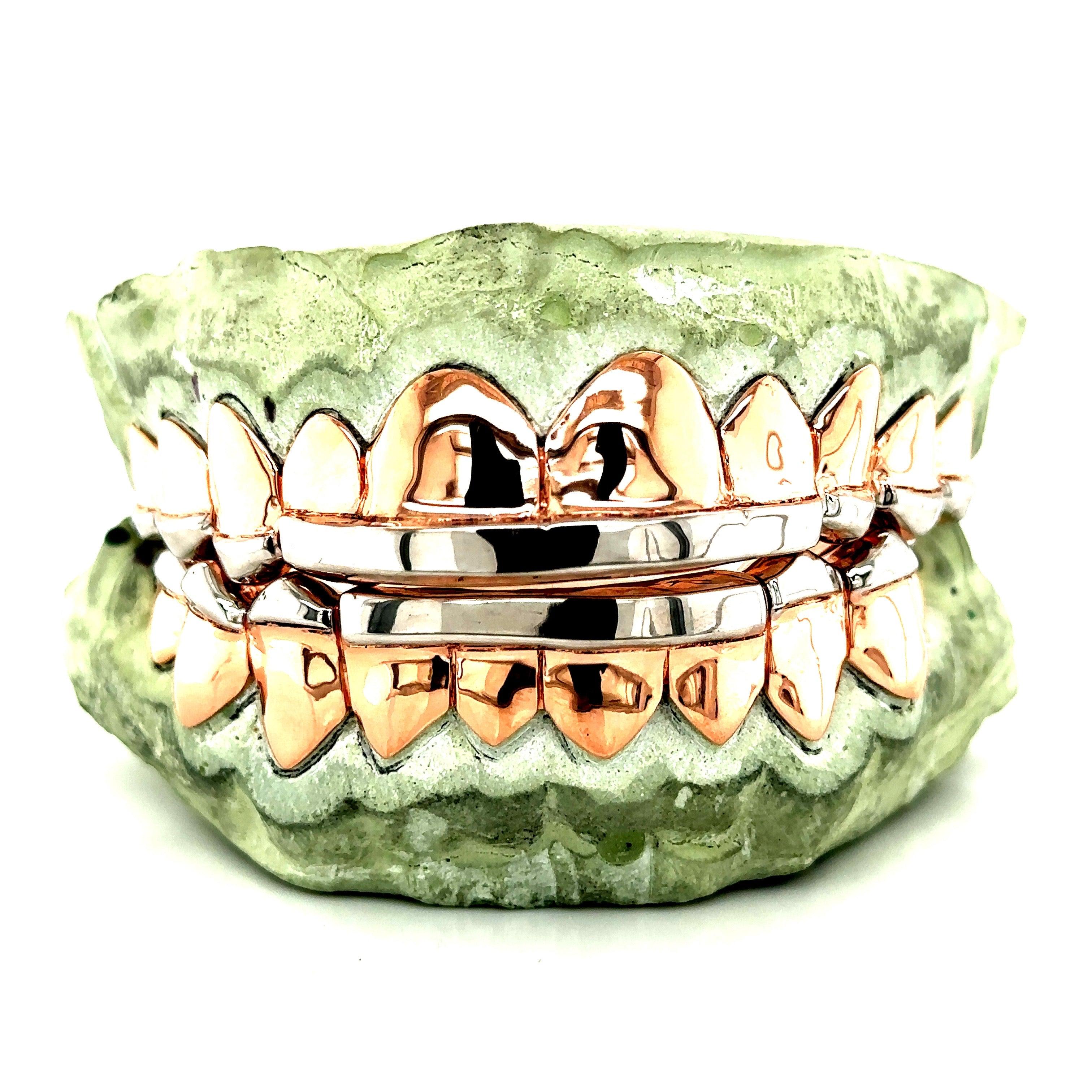 20pc Rose Gold French Tip Grillz - Seattle Gold Grillz