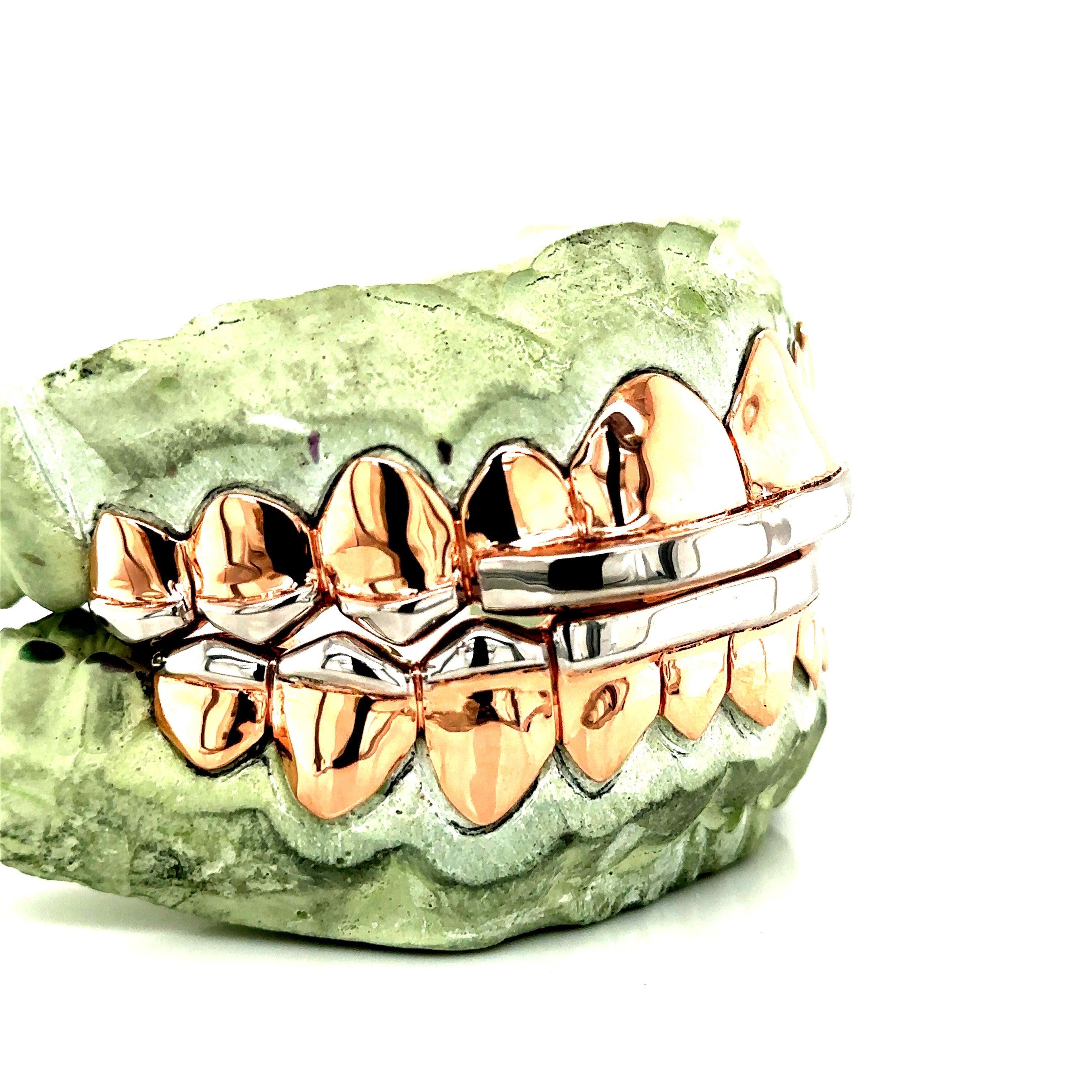20pc Rose Gold French Tip Grillz - Seattle Gold Grillz