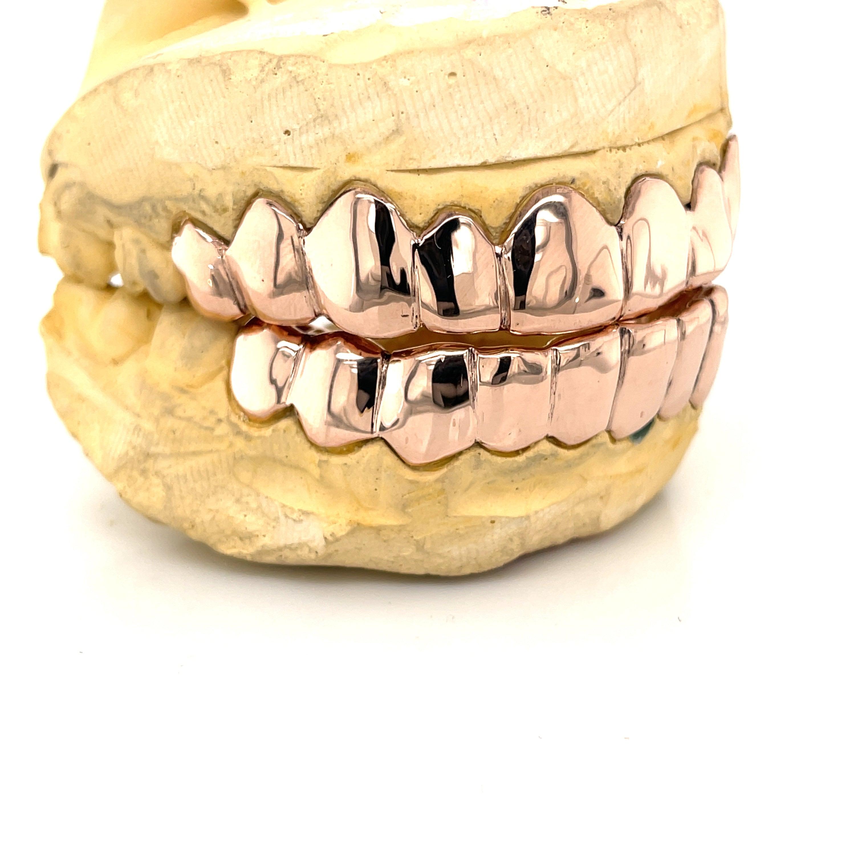 20pc Rose Gold Grillz - Seattle Gold Grillz
