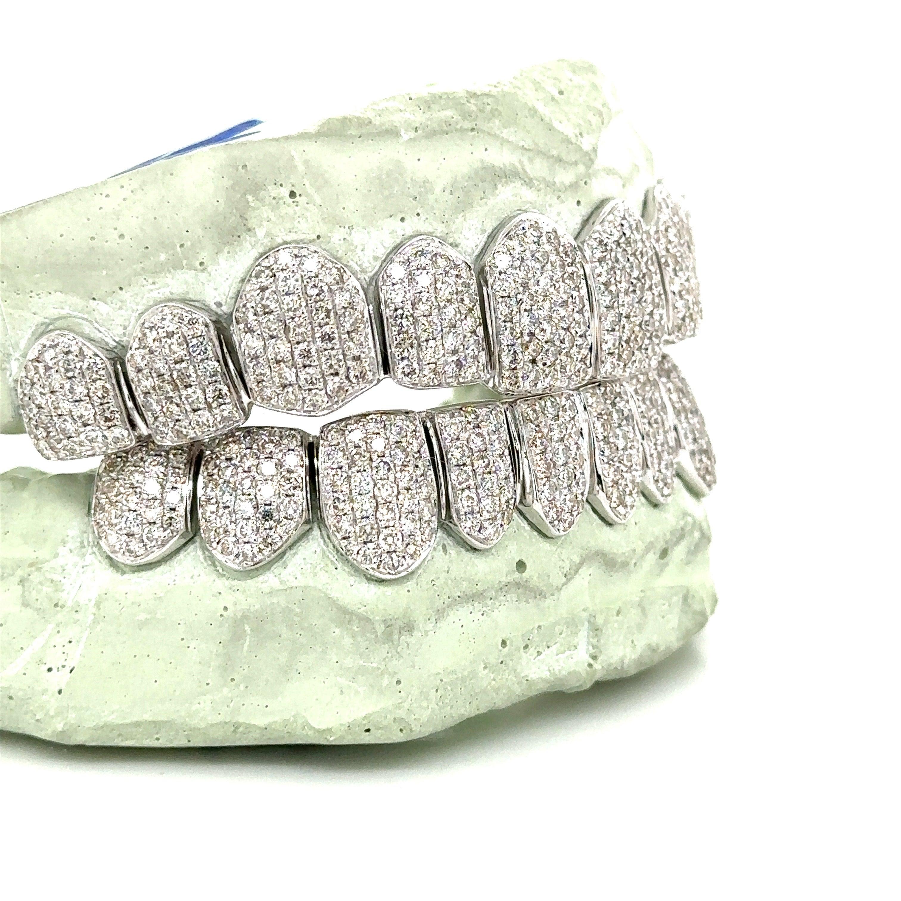 20pc White Gold Honeycomb Diamond Grillz - Seattle Gold Grillz