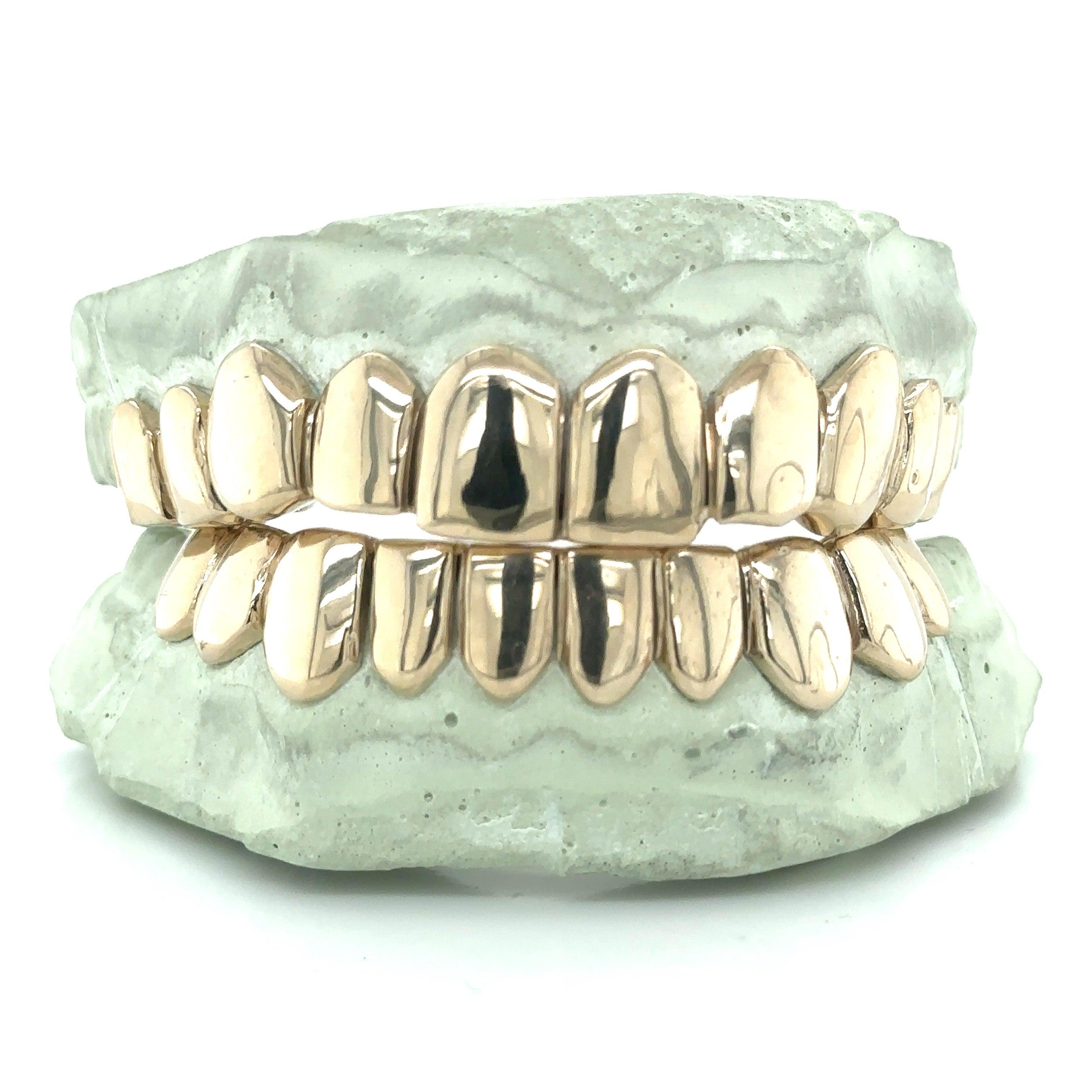 20pc White Gold Perm Cut Grillz - Seattle Gold Grillz