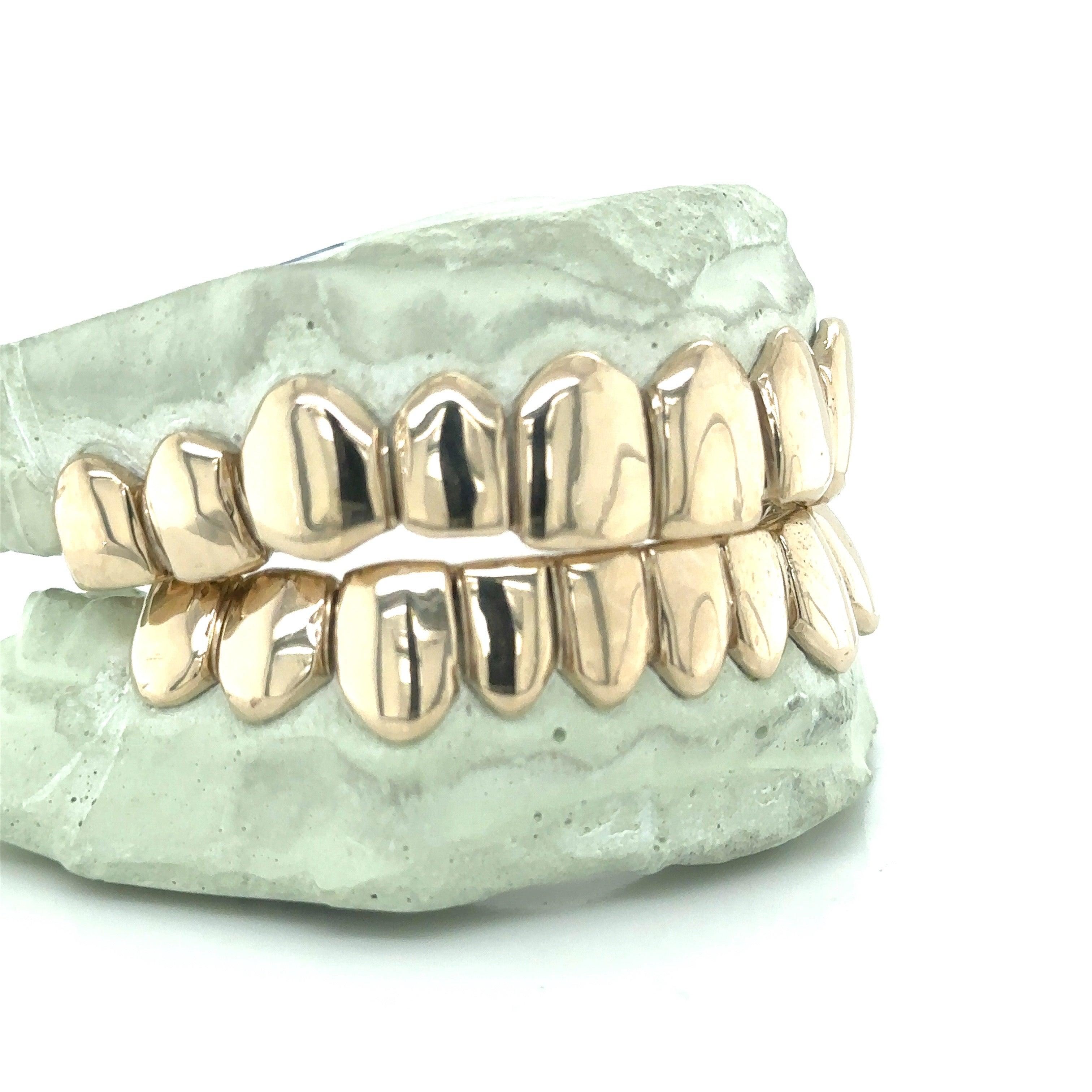 20pc White Gold Perm Cut Grillz - Seattle Gold Grillz