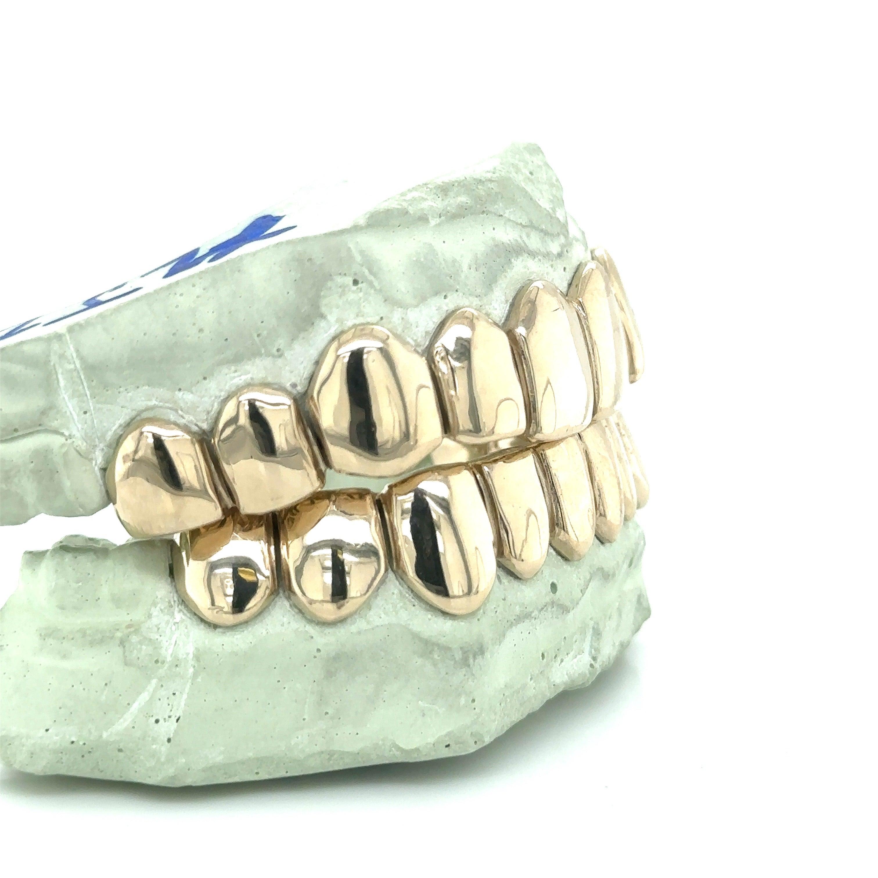 20pc White Gold Perm Cut Grillz - Seattle Gold Grillz