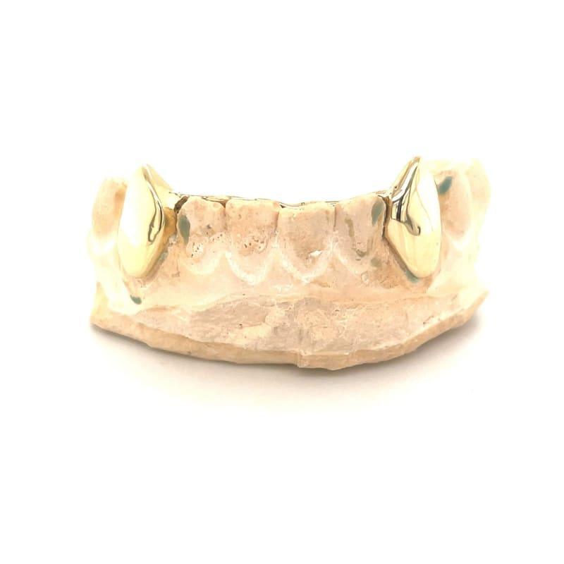 2pc Gold Bottom Fang Grillz - Seattle Gold Grillz