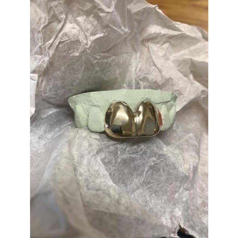 2pc Gold Front Teeth Grillz - Seattle Gold Grillz