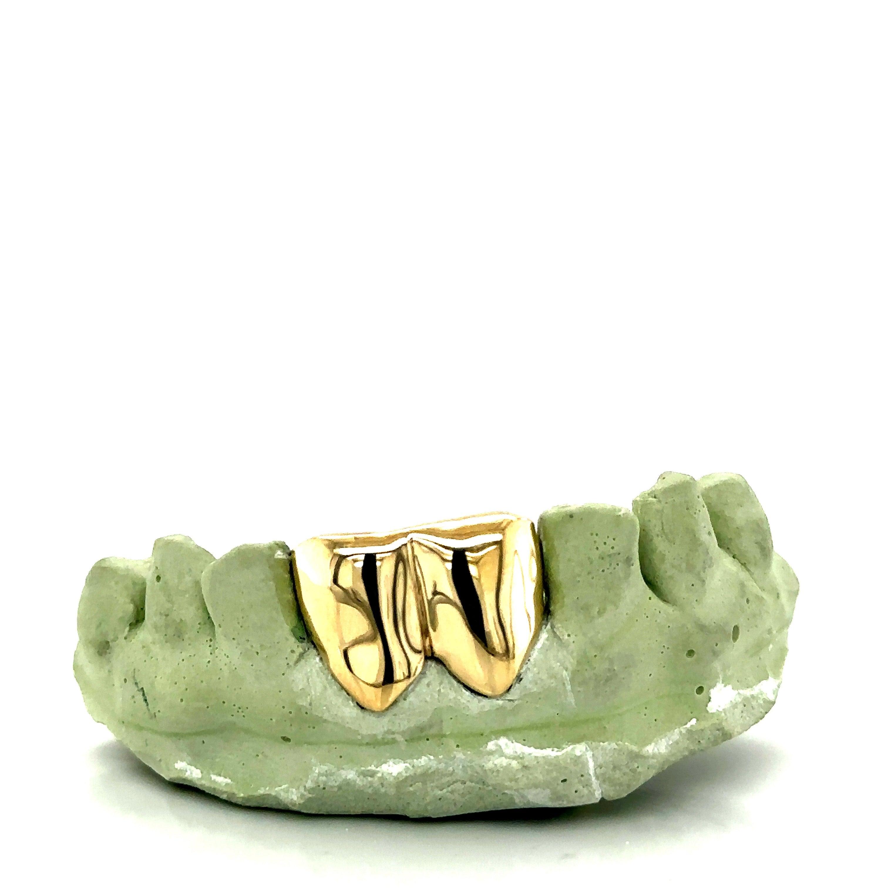 2pc Gold Front Teeth Grillz - Seattle Gold Grillz