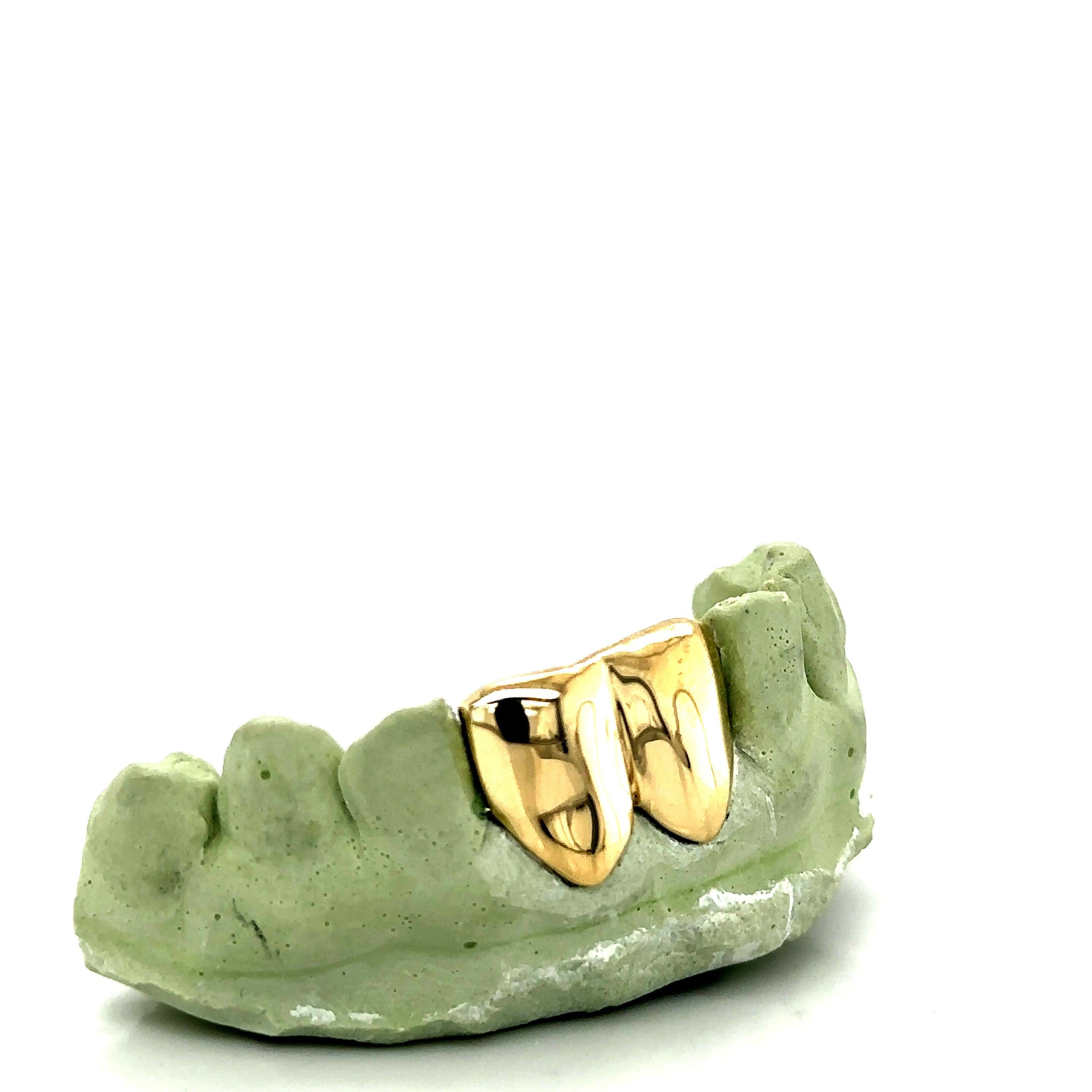 2pc Gold Front Teeth Grillz - Seattle Gold Grillz