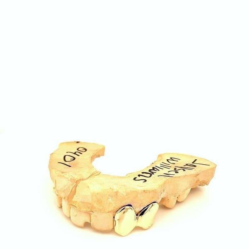 2pc Gold Left Side Grillz - Seattle Gold Grillz