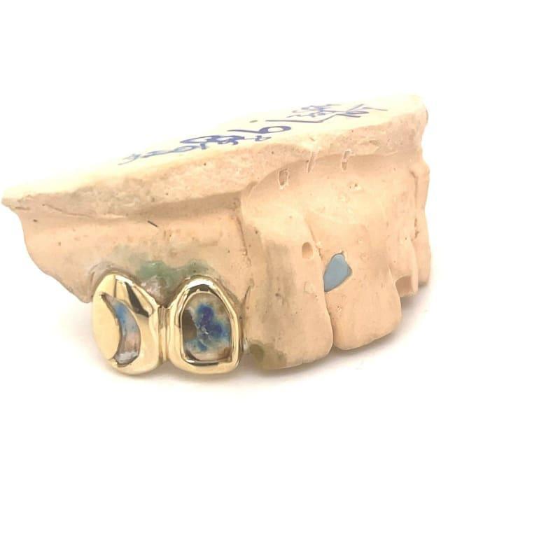 2pc Gold Open Face Grillz - Seattle Gold Grillz