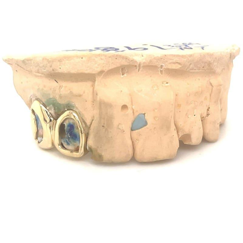 2pc Gold Open Face Grillz - Seattle Gold Grillz