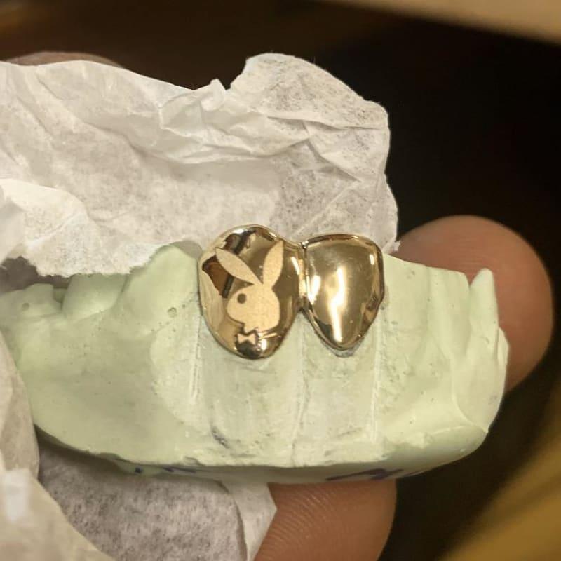 2pc Gold Playboy Bunny & Solid Teeth - Seattle Gold Grillz