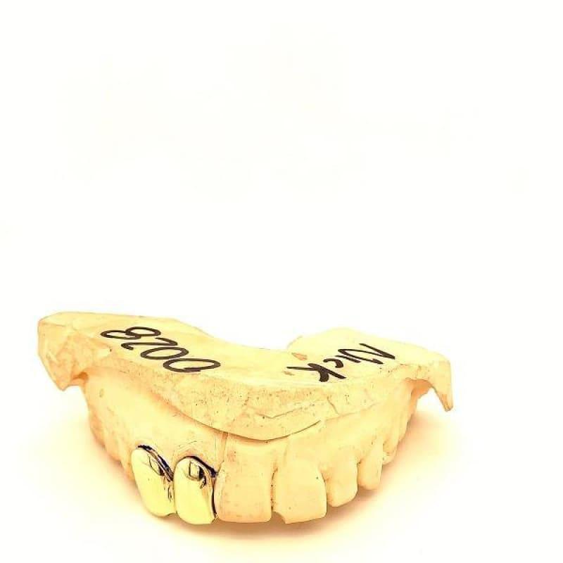 2pc Gold Right Side Grillz - Seattle Gold Grillz