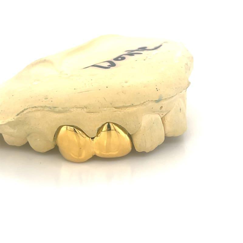 2pc Gold Right Side Grillz - Seattle Gold Grillz