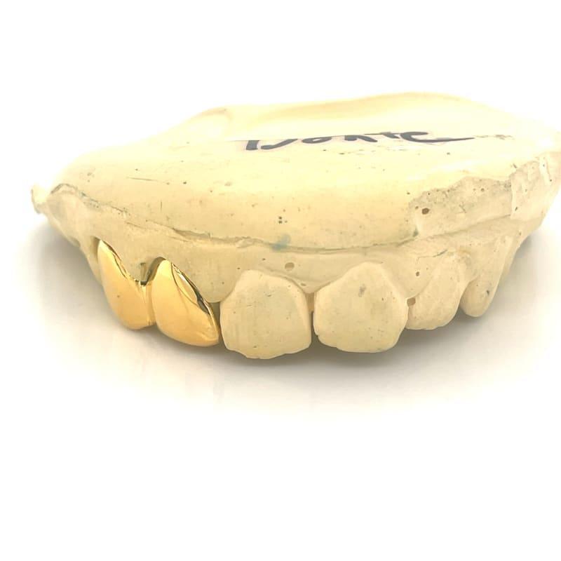 2pc Gold Right Side Grillz - Seattle Gold Grillz