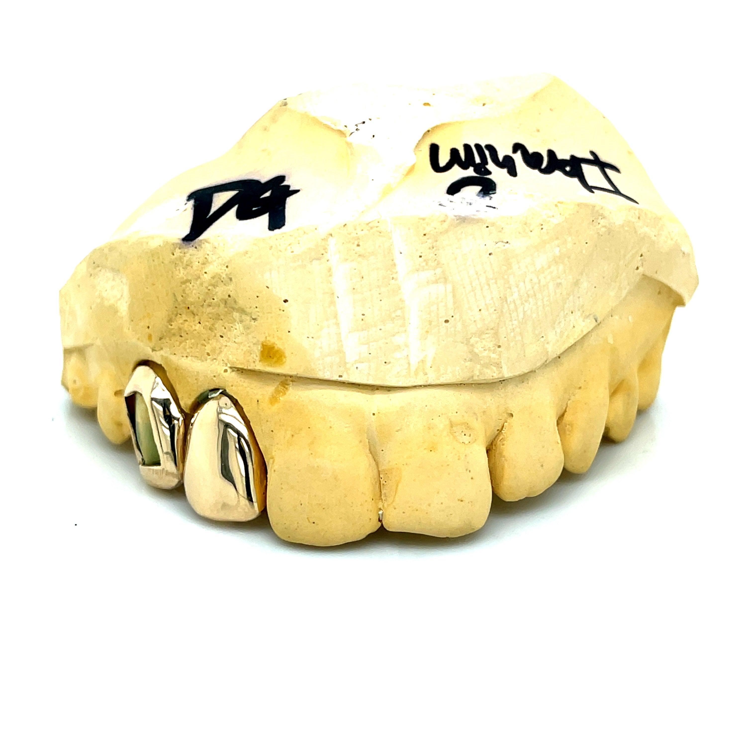 2pc Gold Right Side Open Face Grillz - Seattle Gold Grillz
