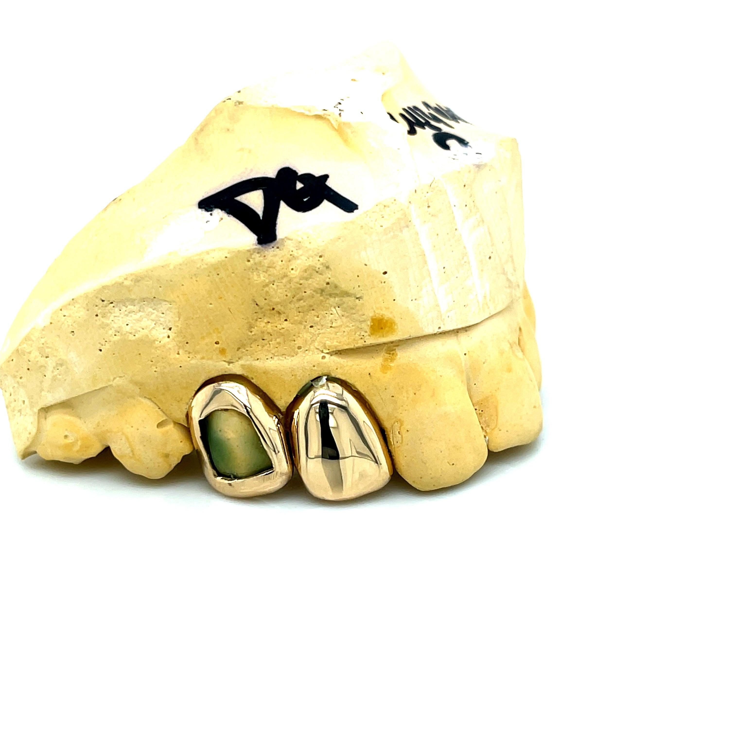 2pc Gold Right Side Open Face Grillz - Seattle Gold Grillz