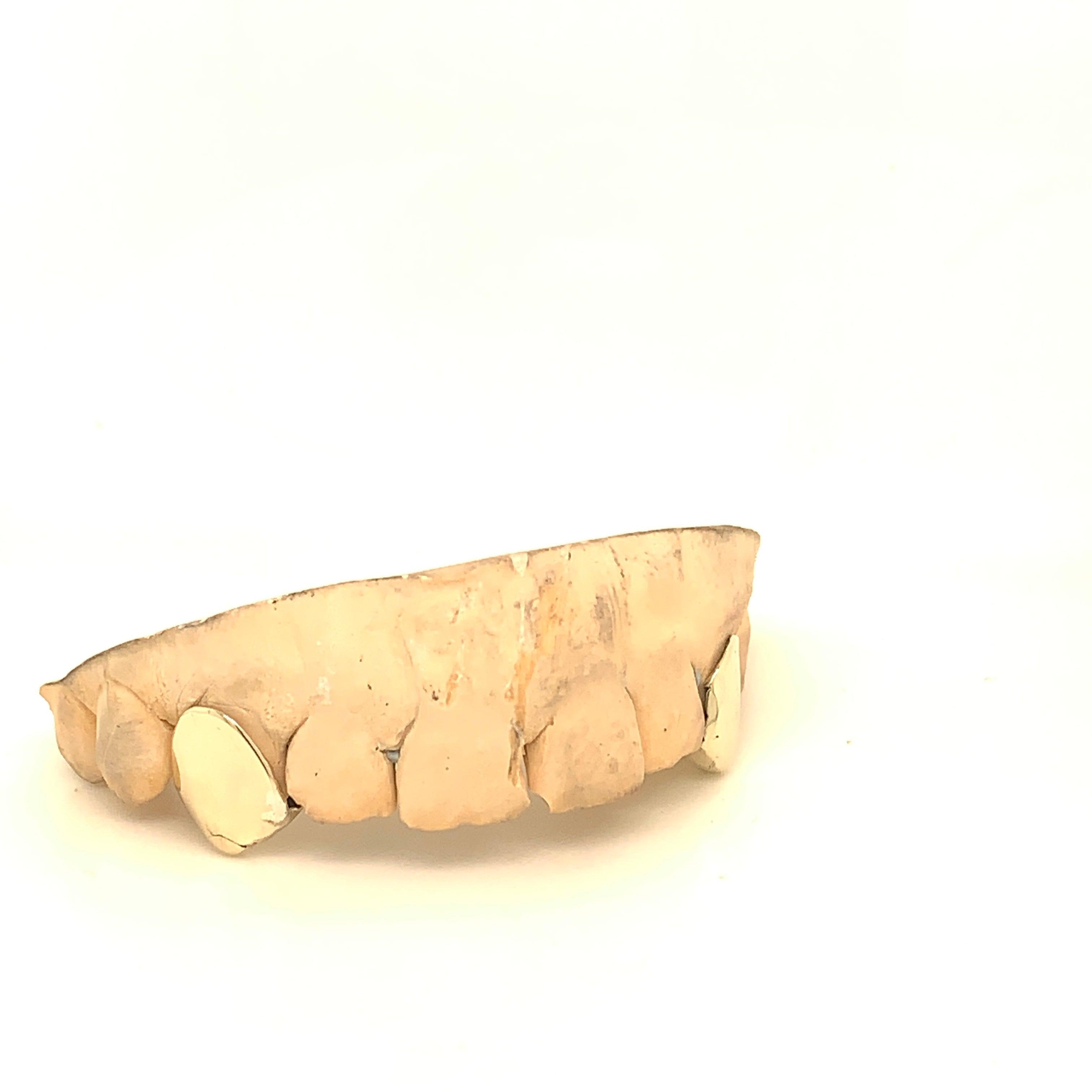 2pc Gold Top Fangs - Seattle Gold Grillz