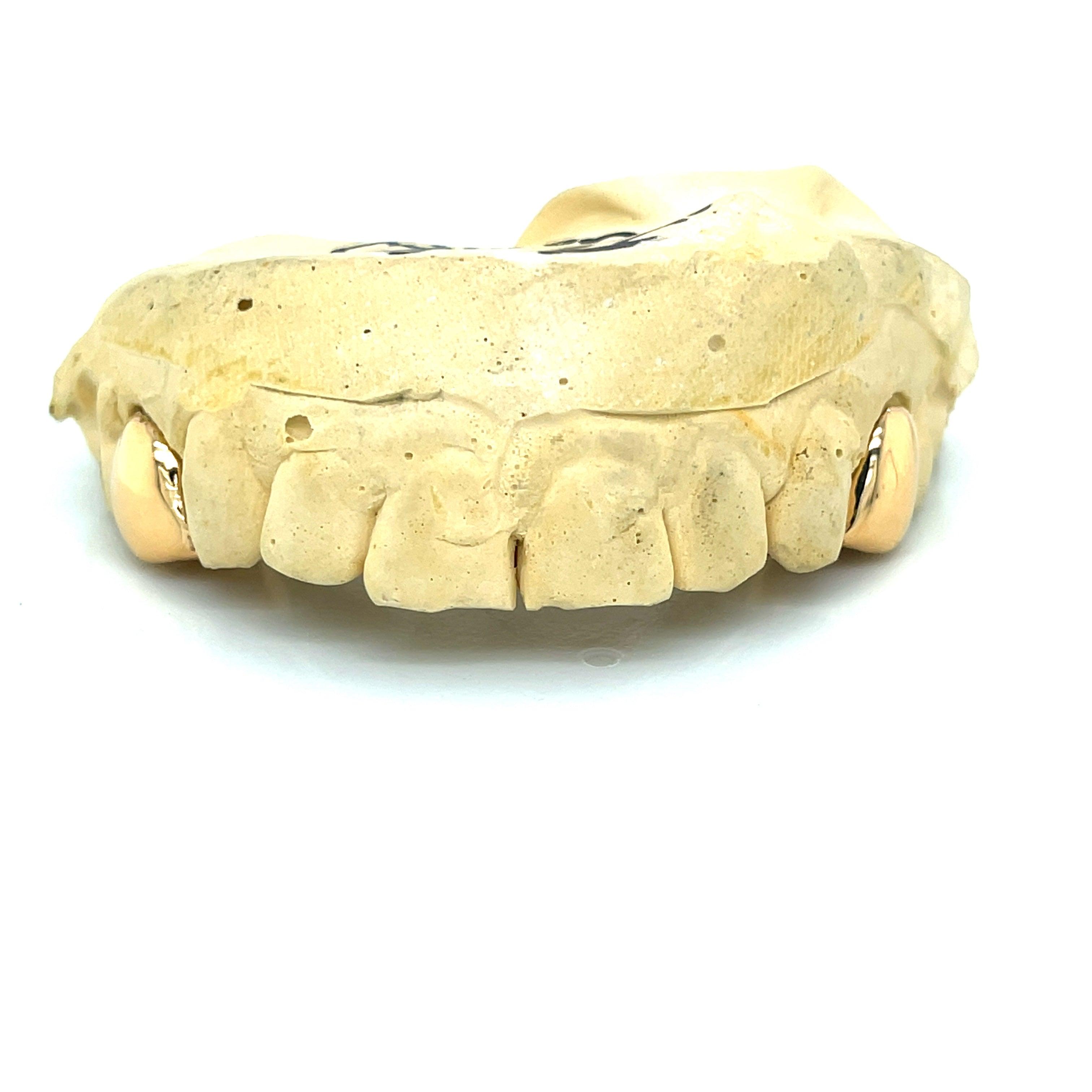 2pc Gold Top Lateral Incisor Grillz - Seattle Gold Grillz