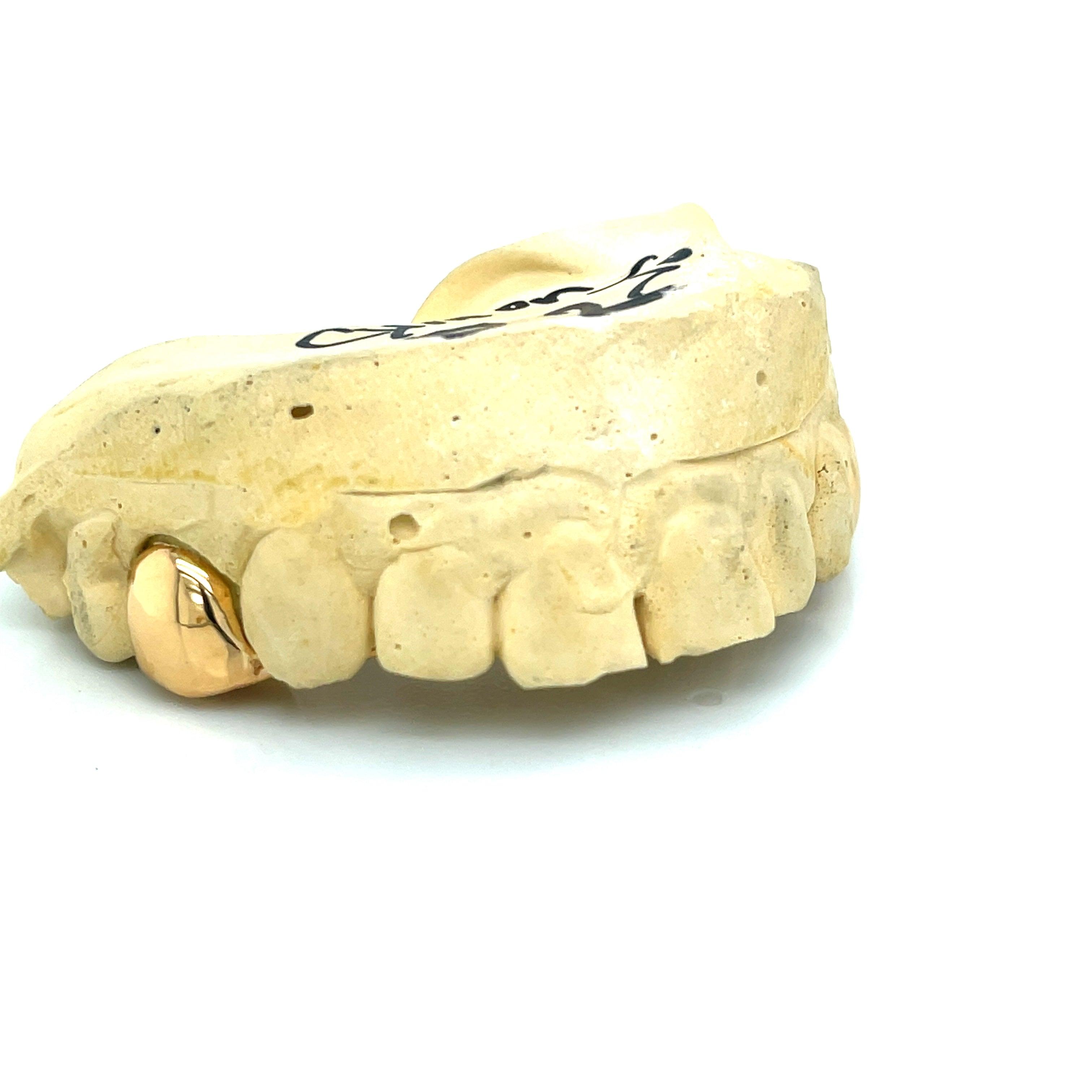 2pc Gold Top Lateral Incisor Grillz - Seattle Gold Grillz