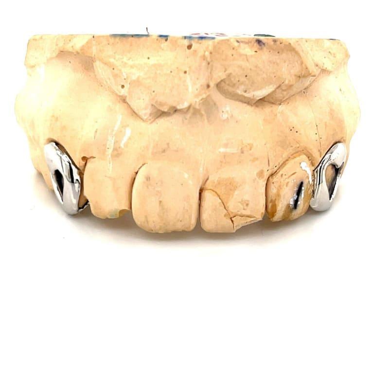 2pc White Gold Heart Open Face Grillz - Seattle Gold Grillz