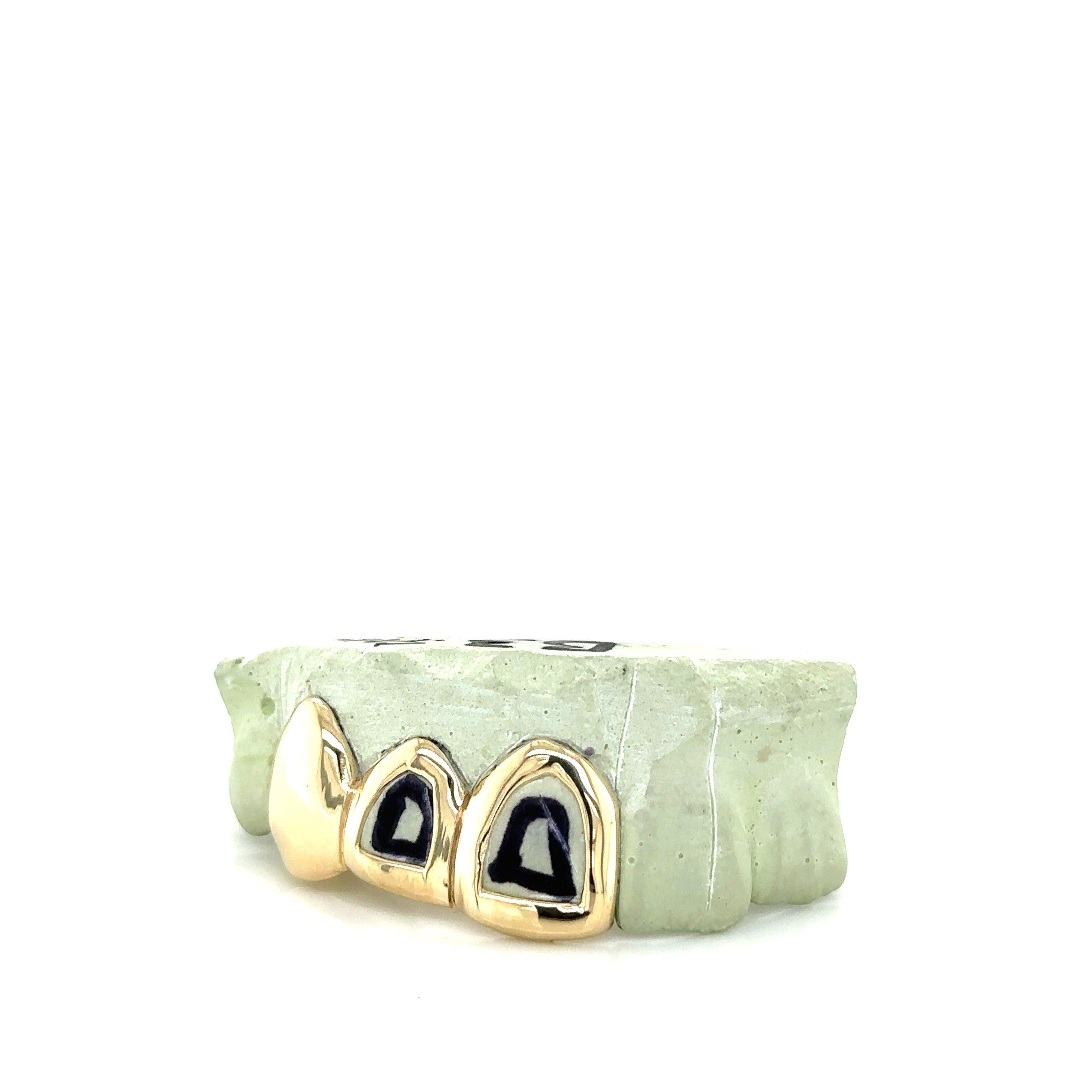 3pc Gold Open Face Top Grillz - Seattle Gold Grillz