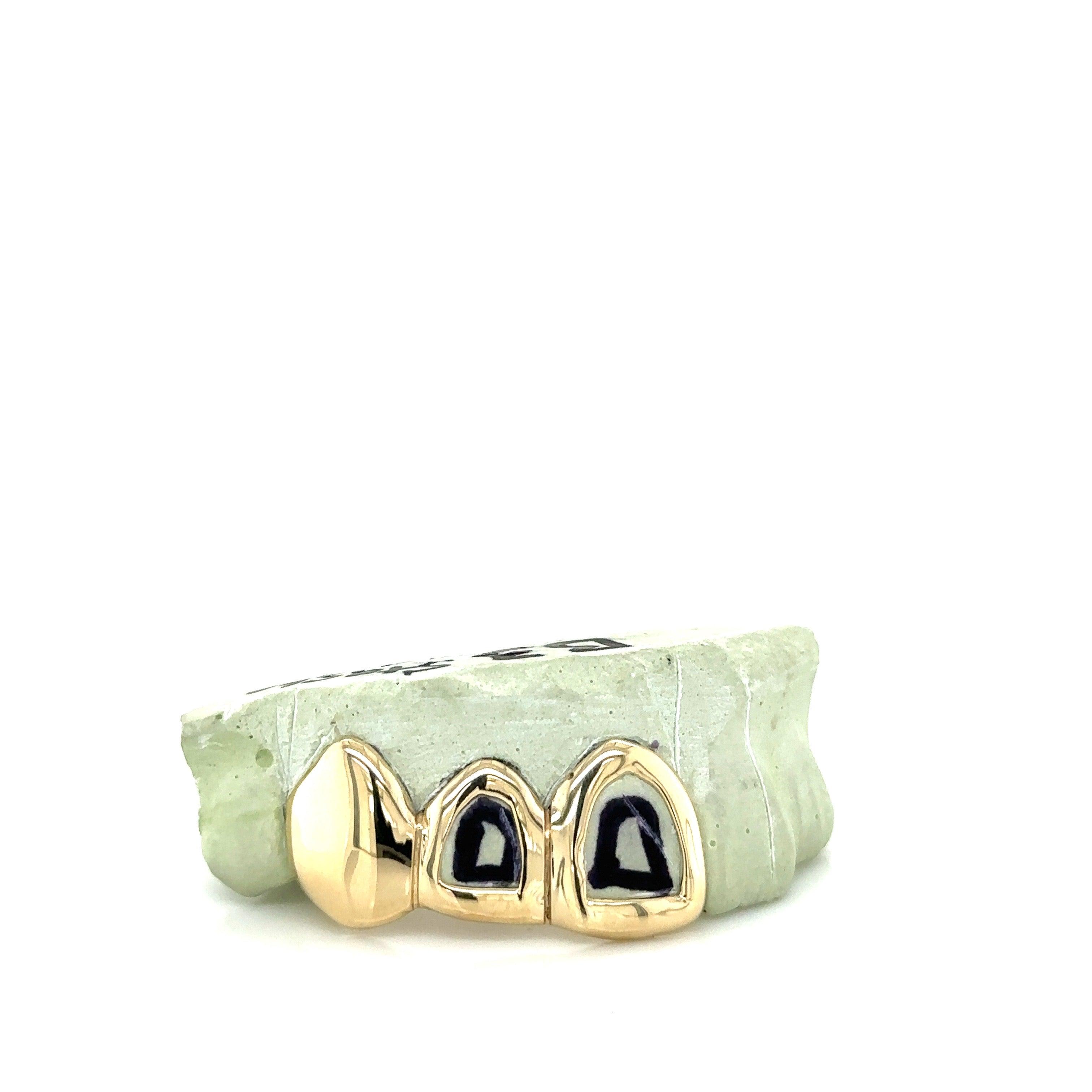 3pc Gold Open Face Top Grillz - Seattle Gold Grillz
