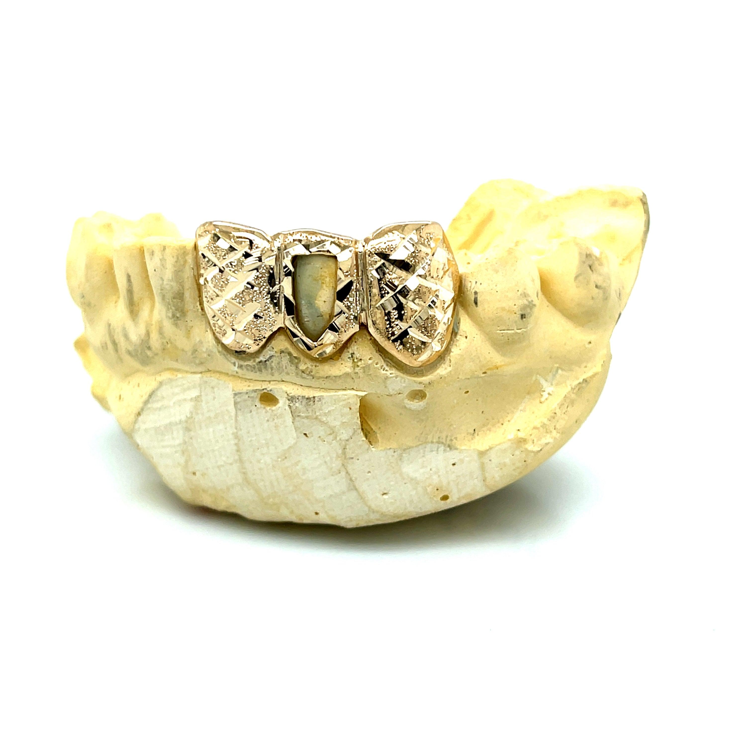 3pc Gold Snowflake Open Face Top Grillz - Seattle Gold Grillz