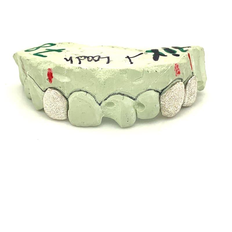 3pc Silver Diamond Dust Grillz - Seattle Gold Grillz