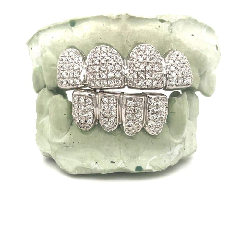 4 Top 4 Bottom Diamond Grillz - Seattle Gold Grillz