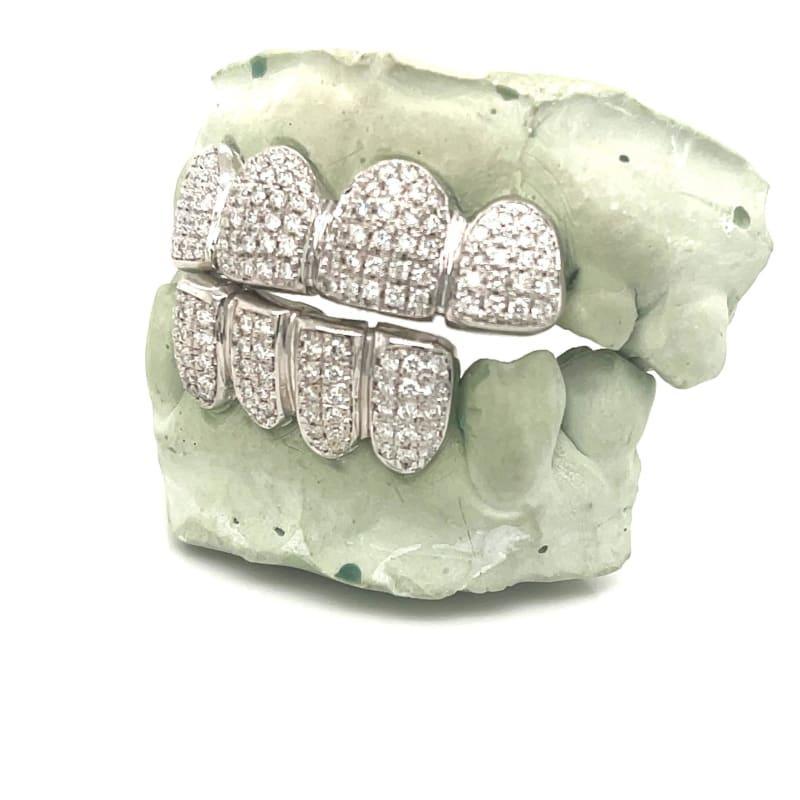 4 Top 4 Bottom Diamond Grillz - Seattle Gold Grillz