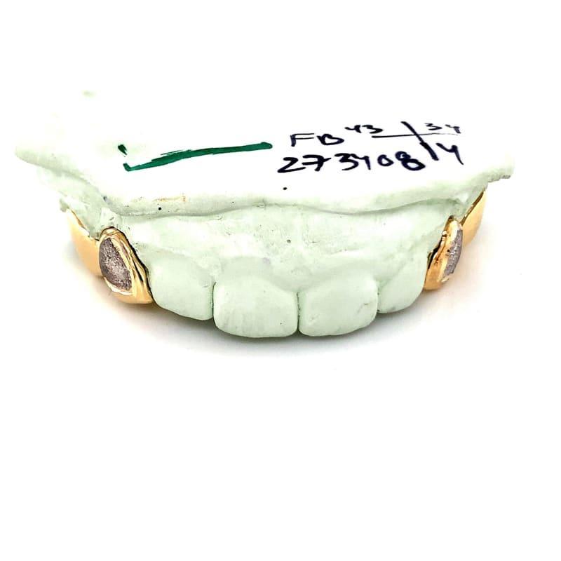 4pc Gold Diamond Dust Grillz - Seattle Gold Grillz
