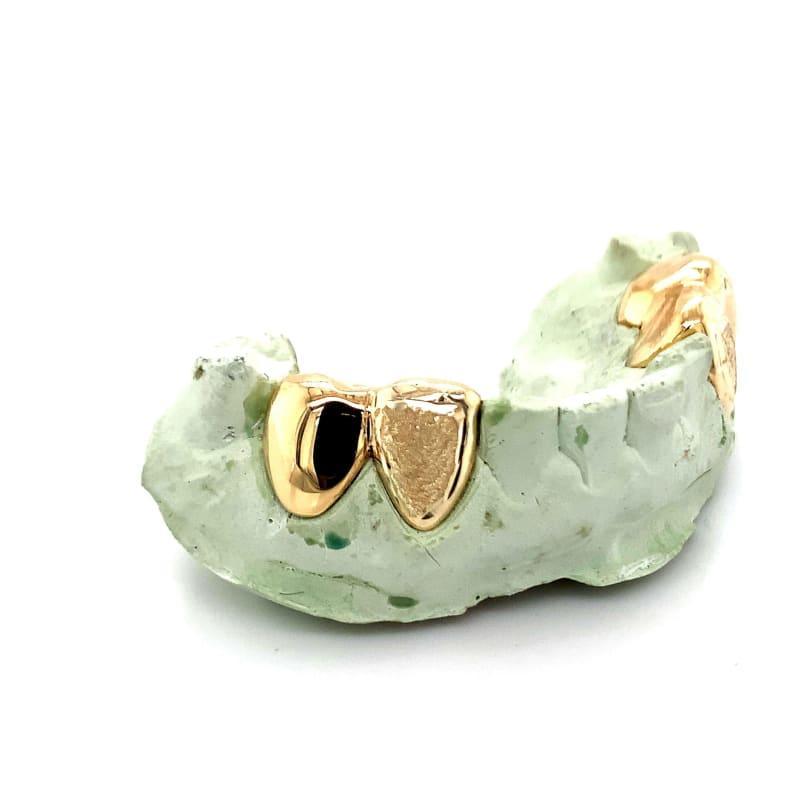 4pc Gold Diamond Dust Grillz - Seattle Gold Grillz