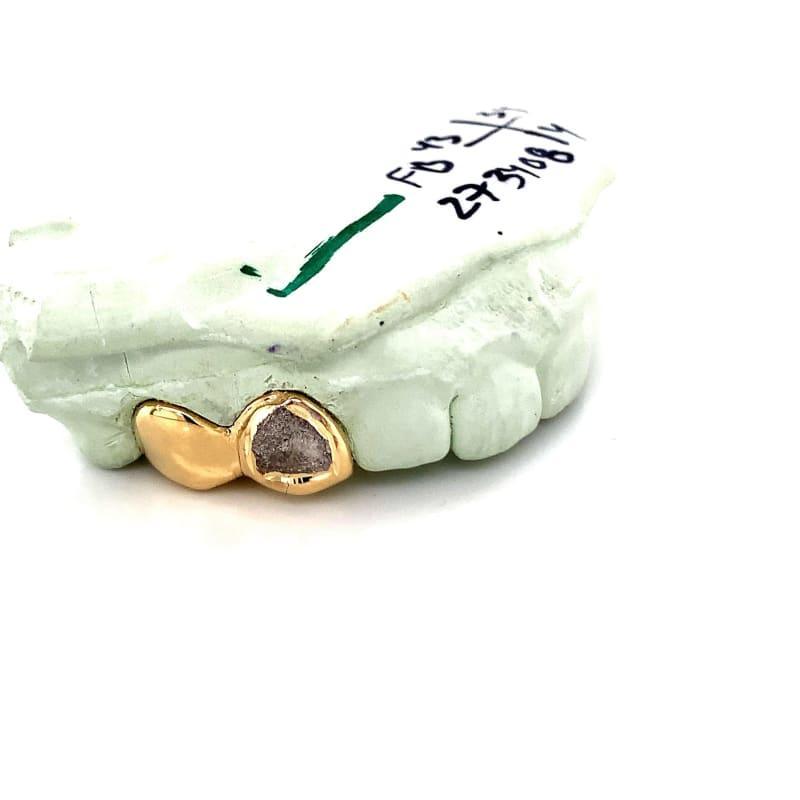 4pc Gold Diamond Dust Grillz - Seattle Gold Grillz