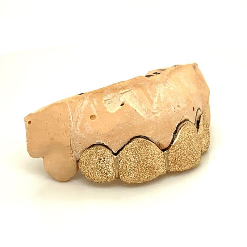 4pc Gold Diamond Dust Top Grillz - Seattle Gold Grillz