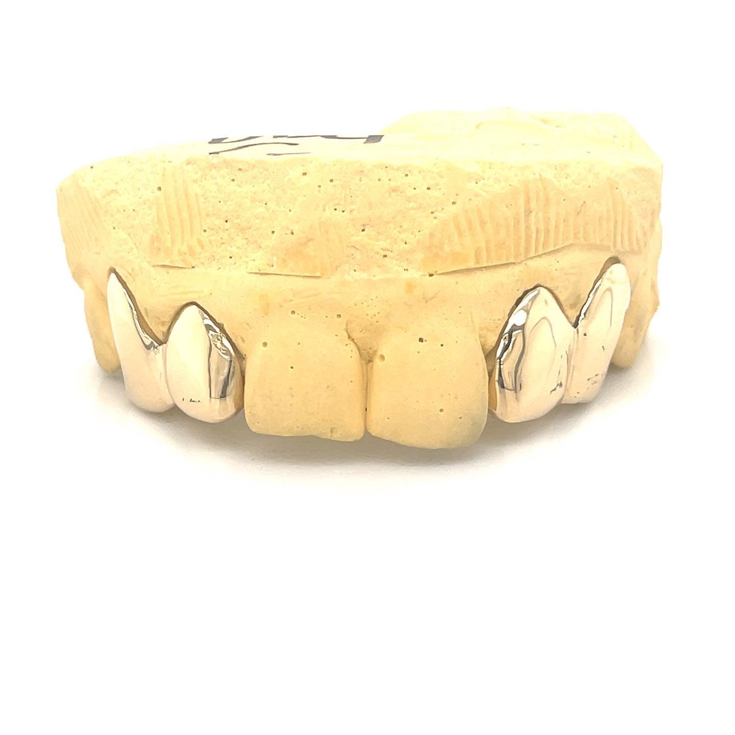 4pc Gold Incisor Fang Top Grillz - Seattle Gold Grillz