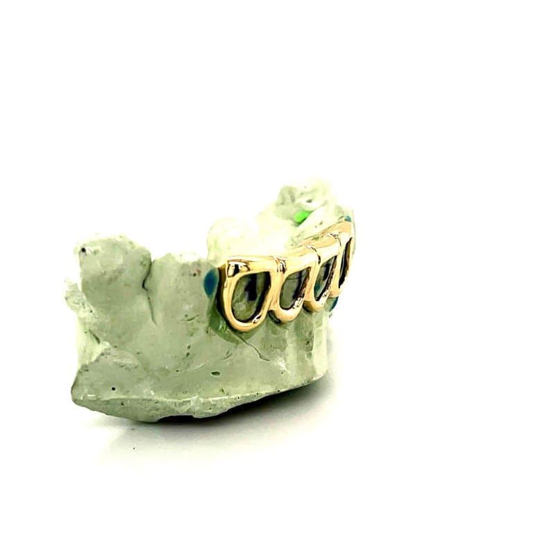 4pc Gold Open Face Grillz - Seattle Gold Grillz