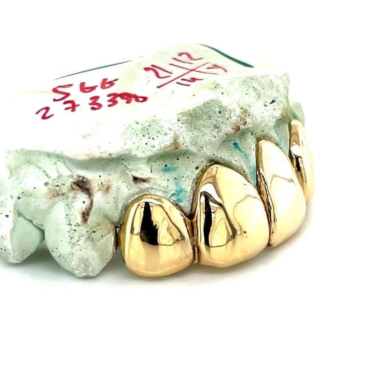 4pc Gold Perm Cut Grillz - Seattle Gold Grillz