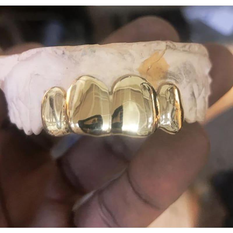 4pc Gold Top Grillz - Seattle Gold Grillz