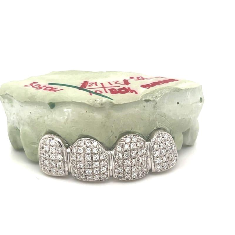 4pc White Gold Diamond Top Grillz - Seattle Gold Grillz