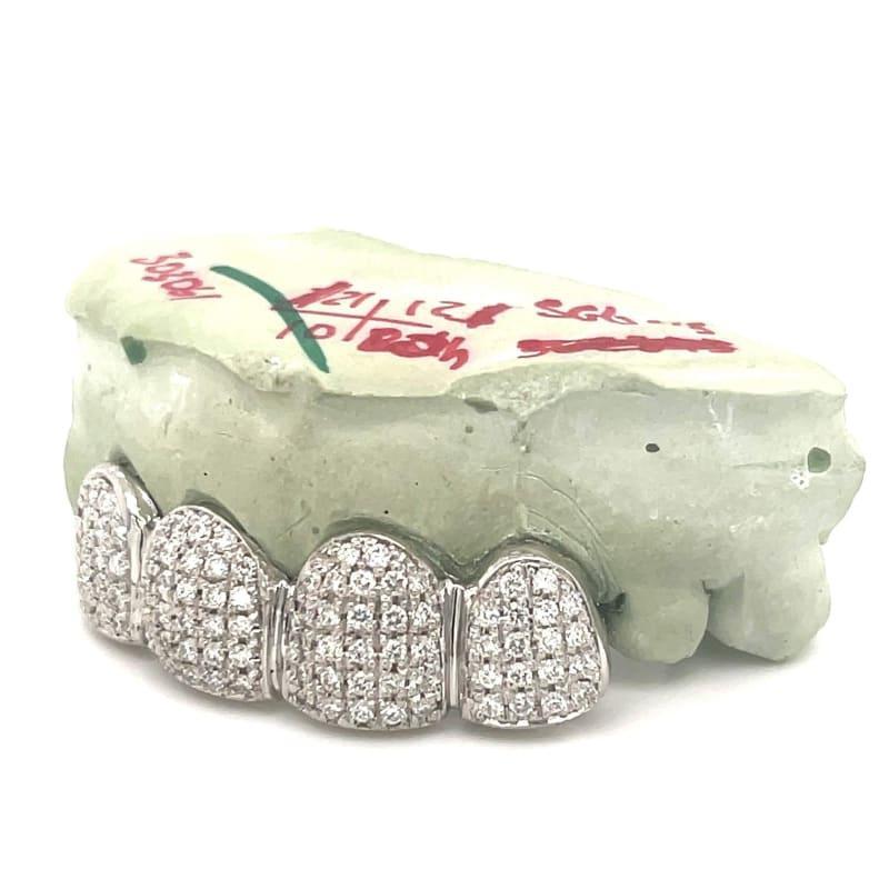 4pc White Gold Diamond Top Grillz - Seattle Gold Grillz