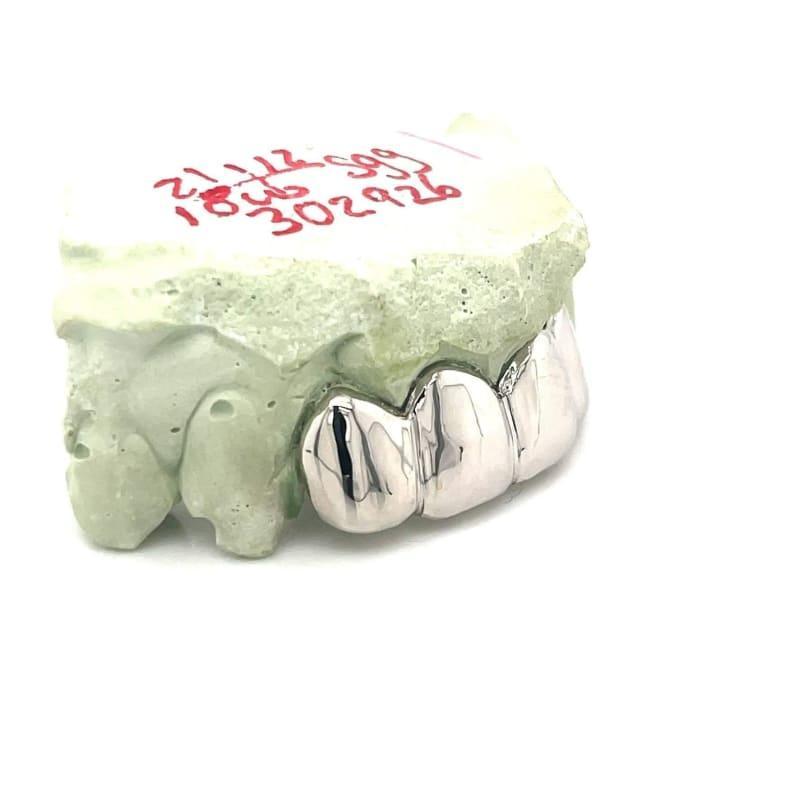 4pc White Gold Top Grillz - Seattle Gold Grillz