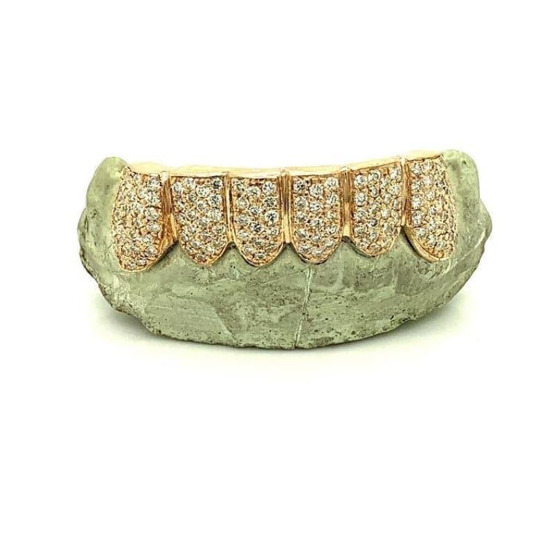 6pc Box Set Diamond Grillz - Seattle Gold Grillz