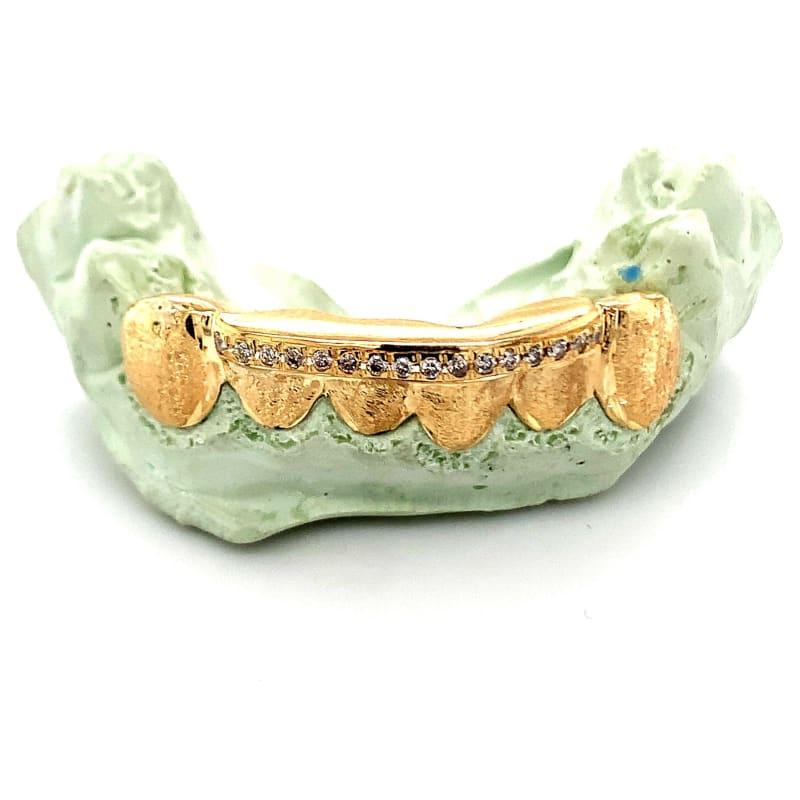 6pc Gold Dusted Diamond Grillz - Seattle Gold Grillz