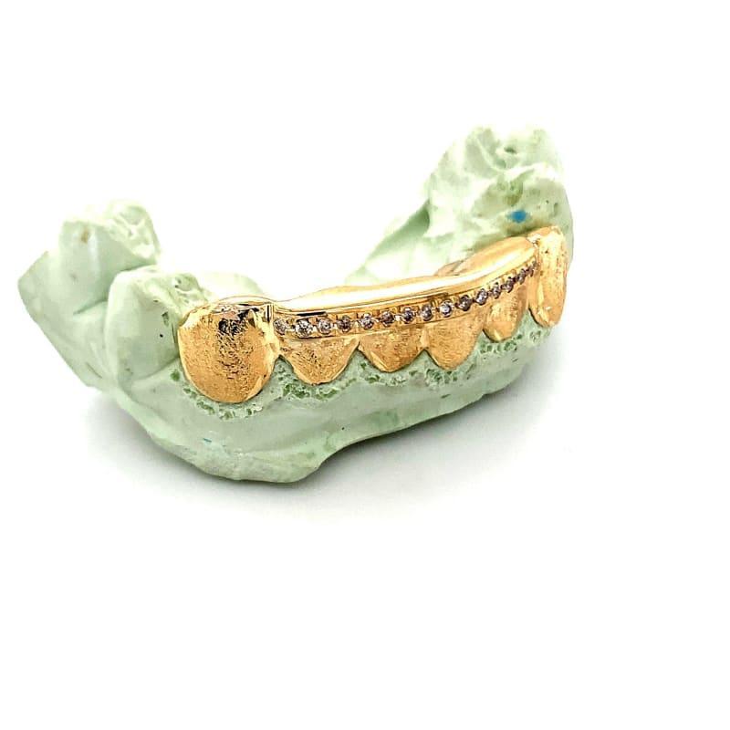 6pc Gold Dusted Diamond Grillz - Seattle Gold Grillz