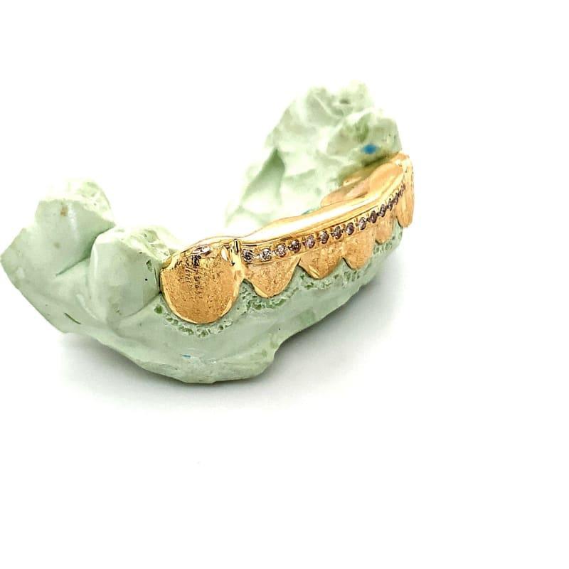 6pc Gold Dusted Diamond Grillz - Seattle Gold Grillz